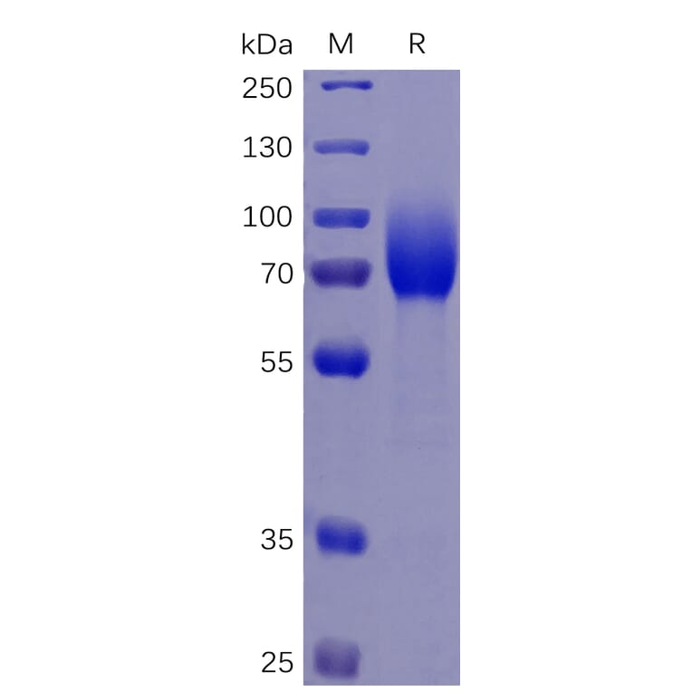 SDS-PAGE - Recombinant Human CSF-1-R Protein (6×His Tag) (A318346) - Antibodies.com