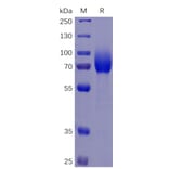 SDS-PAGE - Recombinant Human CSF-1-R Protein (6×His Tag) (A318346) - Antibodies.com