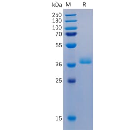 SDS-PAGE - Recombinant Human GPCR GPRC5D Protein (Fc Chimera 6xHis Tag) (A318347) - Antibodies.com