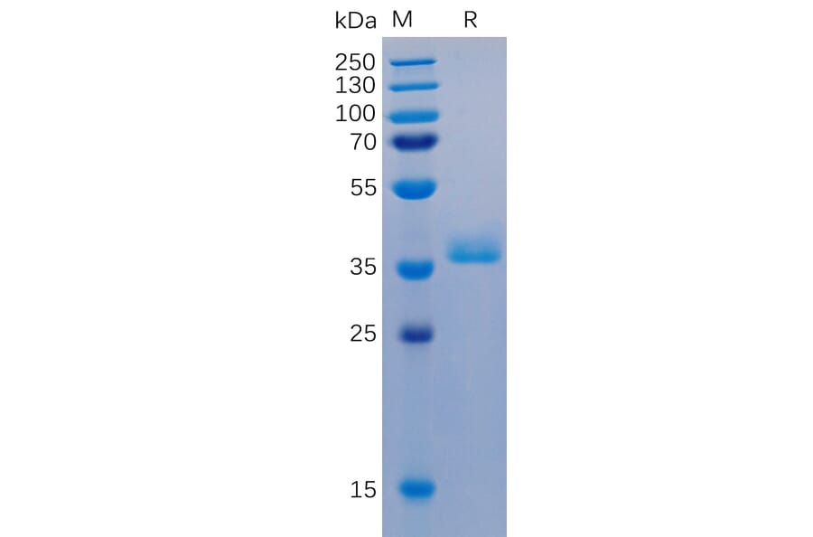 SDS-PAGE - Recombinant Human GPCR GPRC5D Protein (Fc Chimera 6xHis Tag) (A318347) - Antibodies.com