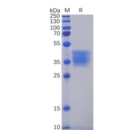 SDS-PAGE - Recombinant Human Claudin 6 Protein (Fc Tag) (A318349) - Antibodies.com