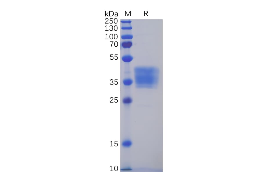 SDS-PAGE - Recombinant Human Claudin 6 Protein (Fc Tag) (A318349) - Antibodies.com
