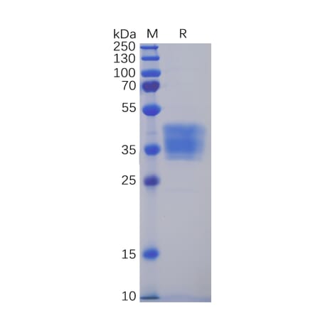 SDS-PAGE - Recombinant Human Claudin 6 Protein (Fc Tag) (A318349) - Antibodies.com