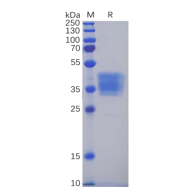 SDS-PAGE - Recombinant Human Claudin 6 Protein (Fc Tag) (A318349) - Antibodies.com