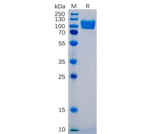 SDS-PAGE - Recombinant Human ICAM1 Protein (Fc Tag) (A318350) - Antibodies.com