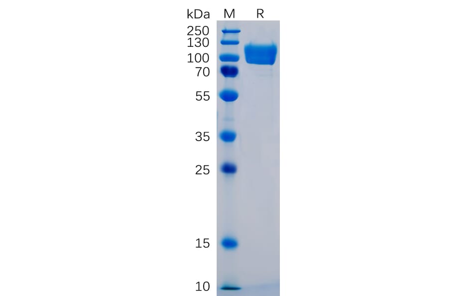 SDS-PAGE - Recombinant Human ICAM1 Protein (Fc Tag) (A318350) - Antibodies.com