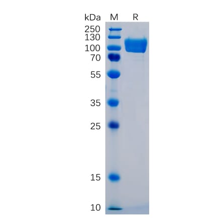 SDS-PAGE - Recombinant Human ICAM1 Protein (Fc Tag) (A318350) - Antibodies.com