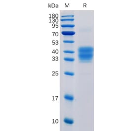 SDS-PAGE - Recombinant Human CD52 Protein (Fc Tag) (A318351) - Antibodies.com