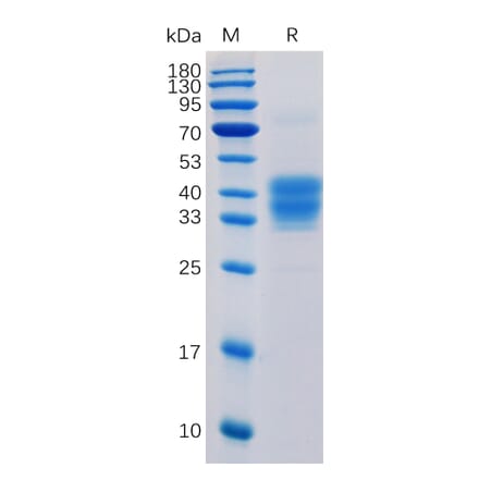 SDS-PAGE - Recombinant Human CD52 Protein (Fc Tag) (A318351) - Antibodies.com