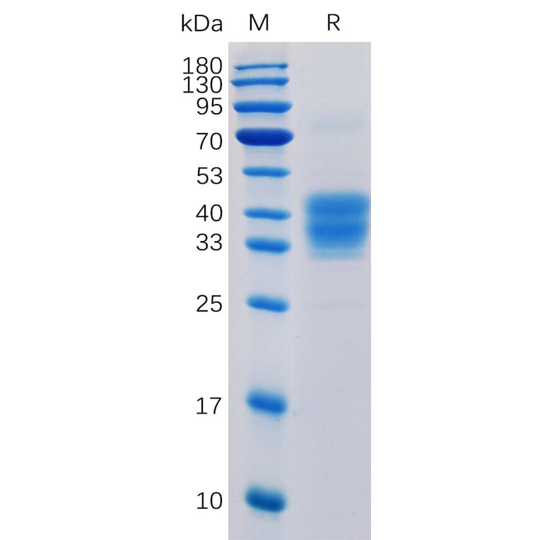 SDS-PAGE - Recombinant Human CD52 Protein (Fc Tag) (A318351) - Antibodies.com