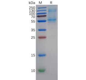 SDS-PAGE - Recombinant Human DLL3 Protein (6×His Tag) (A318352) - Antibodies.com