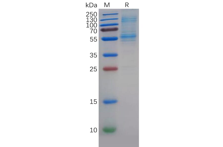 SDS-PAGE - Recombinant Human DLL3 Protein (6×His Tag) (A318352) - Antibodies.com