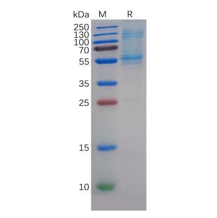 SDS-PAGE - Recombinant Human DLL3 Protein (6×His Tag) (A318352) - Antibodies.com