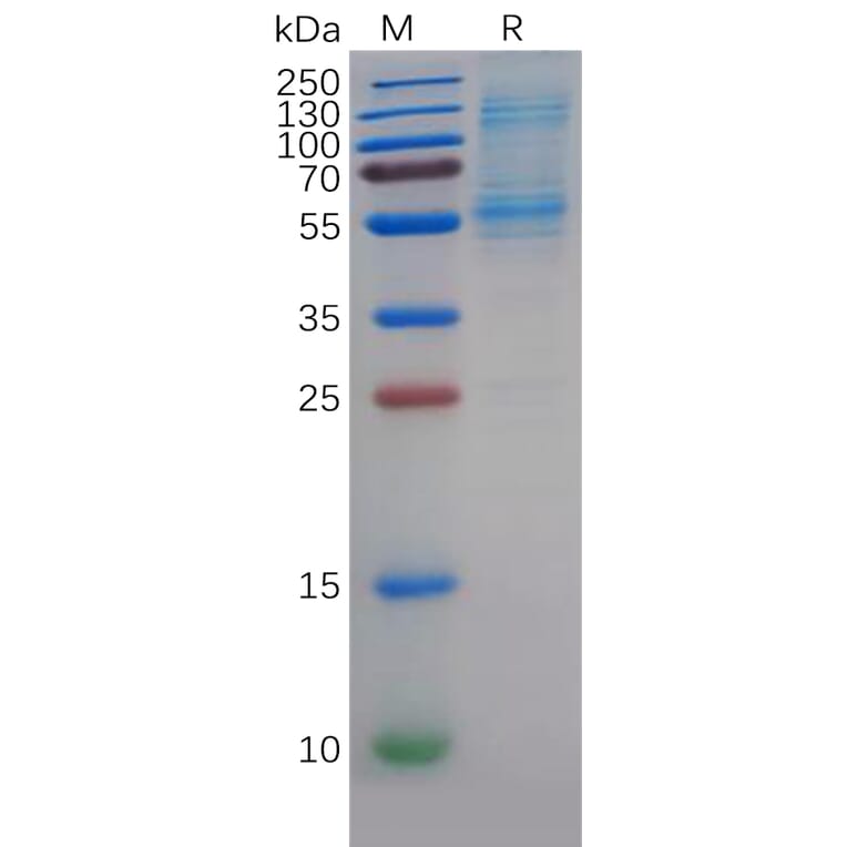 SDS-PAGE - Recombinant Human DLL3 Protein (6×His Tag) (A318352) - Antibodies.com