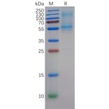SDS-PAGE - Recombinant Human DLL3 Protein (6×His Tag) (A318352) - Antibodies.com