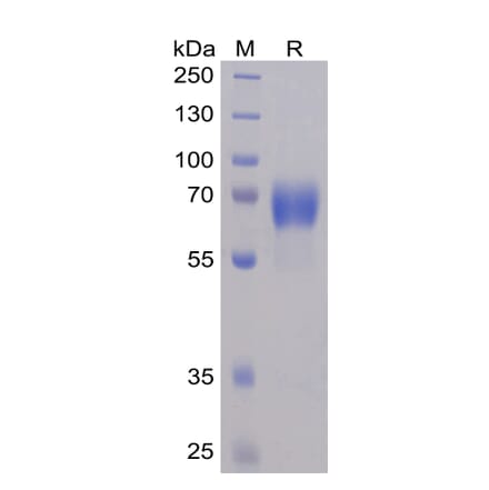 SDS-PAGE - Recombinant Human SLAMF6 Protein (Fc Chimera 6xHis Tag) (A318353) - Antibodies.com