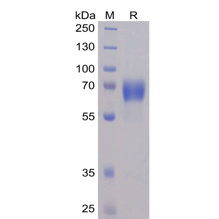 SDS-PAGE - Recombinant Human SLAMF6 Protein (Fc Chimera 6xHis Tag) (A318353) - Antibodies.com