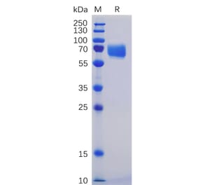 SDS-PAGE - Recombinant Human CD84 Protein (Fc Chimera 6xHis Tag) (A318354) - Antibodies.com