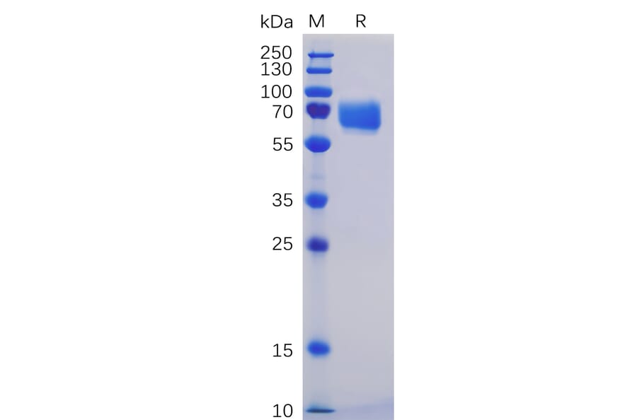 SDS-PAGE - Recombinant Human CD84 Protein (Fc Chimera 6xHis Tag) (A318354) - Antibodies.com