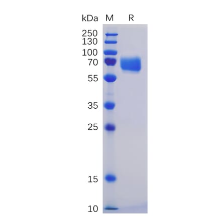 SDS-PAGE - Recombinant Human CD84 Protein (Fc Chimera 6xHis Tag) (A318354) - Antibodies.com