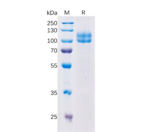 SDS-PAGE - Recombinant Human CD229 Protein (Fc Tag) (A318355) - Antibodies.com