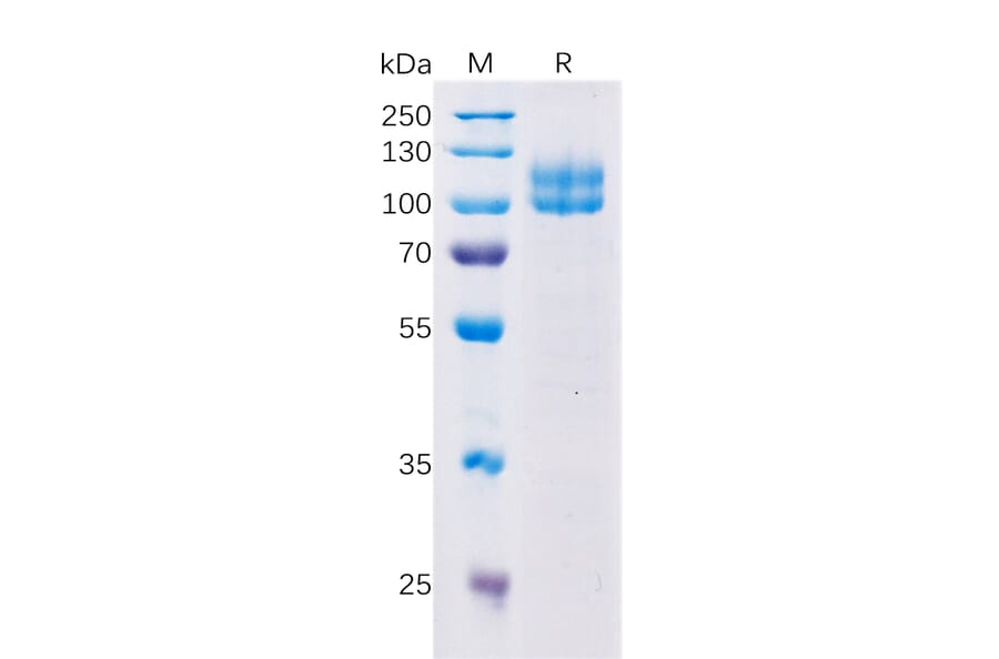 SDS-PAGE - Recombinant Human CD229 Protein (Fc Tag) (A318355) - Antibodies.com