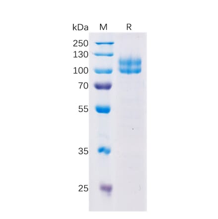 SDS-PAGE - Recombinant Human CD229 Protein (Fc Tag) (A318355) - Antibodies.com