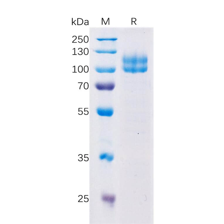 SDS-PAGE - Recombinant Human CD229 Protein (Fc Tag) (A318355) - Antibodies.com