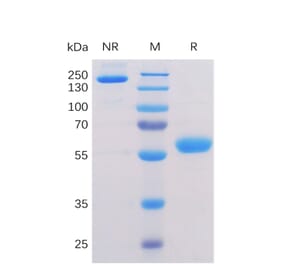 SDS-PAGE - Recombinant Human BTN3A1 Protein (Fc Chimera 6xHis Tag) (A318356) - Antibodies.com