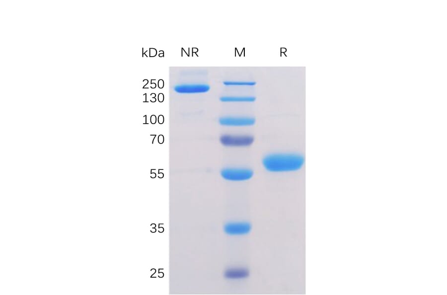 SDS-PAGE - Recombinant Human BTN3A1 Protein (Fc Chimera 6xHis Tag) (A318356) - Antibodies.com