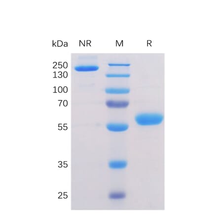 SDS-PAGE - Recombinant Human BTN3A1 Protein (Fc Chimera 6xHis Tag) (A318356) - Antibodies.com