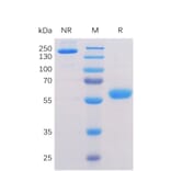SDS-PAGE - Recombinant Human BTN3A1 Protein (Fc Chimera 6xHis Tag) (A318356) - Antibodies.com