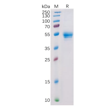 SDS-PAGE - Recombinant Human CD160 Protein (Fc Tag) (A318357) - Antibodies.com