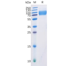SDS-PAGE - Recombinant Human CD226 Protein (Fc Chimera 6xHis Tag) (A318360) - Antibodies.com