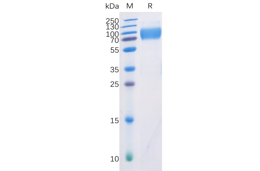 SDS-PAGE - Recombinant Human CD226 Protein (Fc Chimera 6xHis Tag) (A318360) - Antibodies.com