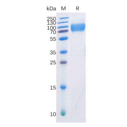 SDS-PAGE - Recombinant Human CD226 Protein (Fc Chimera 6xHis Tag) (A318360) - Antibodies.com