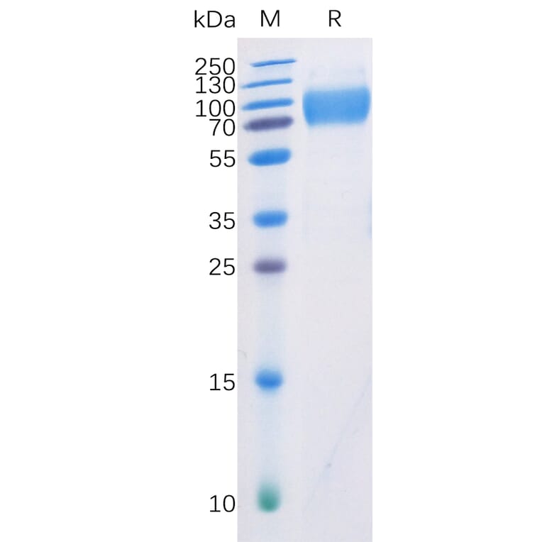SDS-PAGE - Recombinant Human CD226 Protein (Fc Chimera 6xHis Tag) (A318360) - Antibodies.com