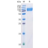 SDS-PAGE - Recombinant Human CD226 Protein (Fc Chimera 6xHis Tag) (A318360) - Antibodies.com