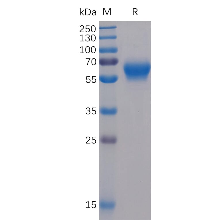 SDS-PAGE - Recombinant Human CD272/BTLA Protein (Fc Chimera 6xHis Tag) (A318362) - Antibodies.com