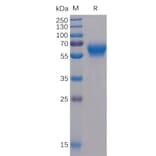 SDS-PAGE - Recombinant Human CD272/BTLA Protein (Fc Chimera 6xHis Tag) (A318362) - Antibodies.com