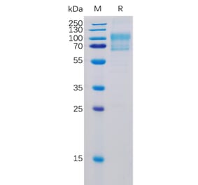 SDS-PAGE - Recombinant Human CD80 Protein (Fc Chimera 6xHis Tag) (A318363) - Antibodies.com