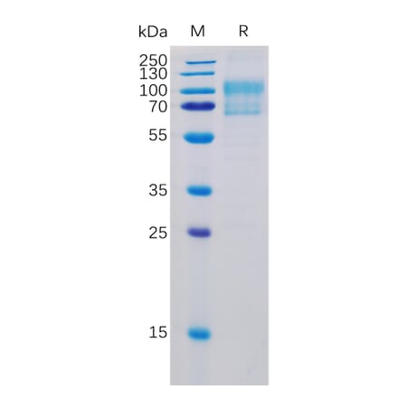 SDS-PAGE - Recombinant Human CD80 Protein (Fc Chimera 6xHis Tag) (A318363) - Antibodies.com