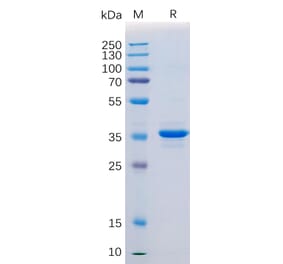 SDS-PAGE - Recombinant Human CD20 Protein (Fc Tag) (A318364) - Antibodies.com