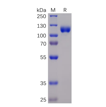 SDS-PAGE - Recombinant Human Eph Receptor A3 Protein (Fc Chimera 6xHis Tag) (A318365) - Antibodies.com