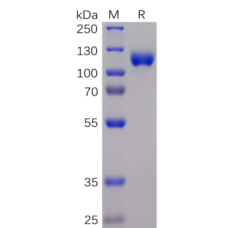 SDS-PAGE - Recombinant Human Eph Receptor A3 Protein (Fc Chimera 6xHis Tag) (A318365) - Antibodies.com