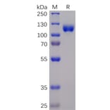 SDS-PAGE - Recombinant Human Eph Receptor A3 Protein (Fc Chimera 6xHis Tag) (A318365) - Antibodies.com