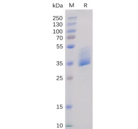 SDS-PAGE - Recombinant Human BAFF-R Protein (Fc Tag) (A318366) - Antibodies.com