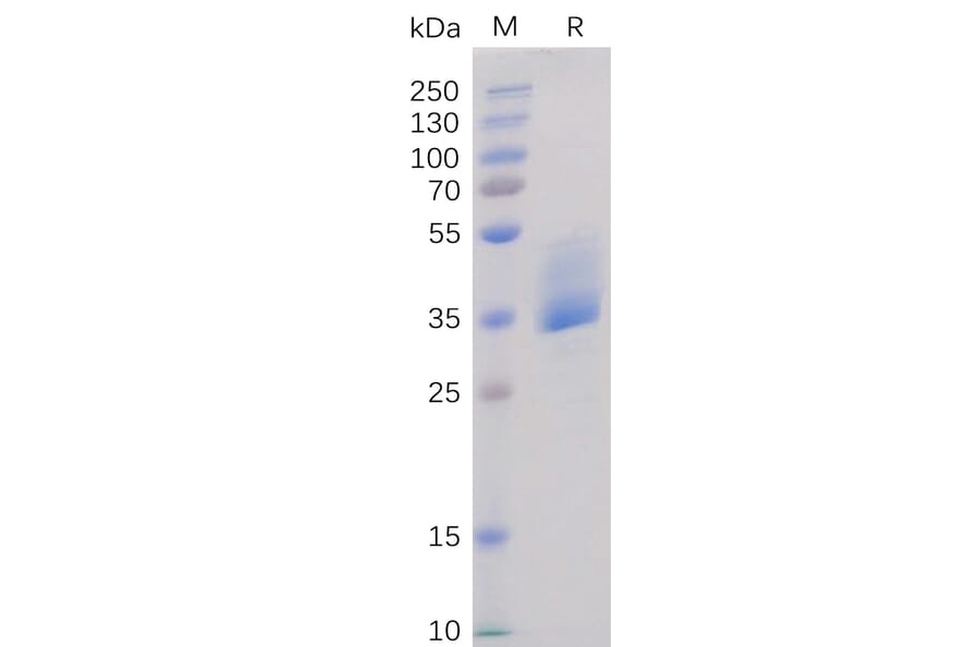 SDS-PAGE - Recombinant Human BAFF-R Protein (Fc Tag) (A318366) - Antibodies.com