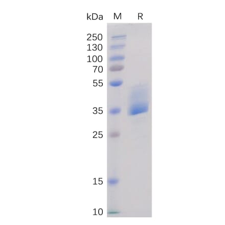 SDS-PAGE - Recombinant Human BAFF-R Protein (Fc Tag) (A318366) - Antibodies.com