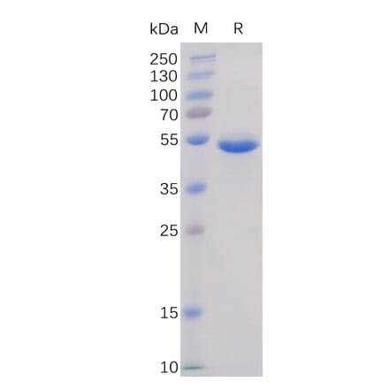 SDS-PAGE - Recombinant Human BAFF Protein (Fc Tag) (A318367) - Antibodies.com